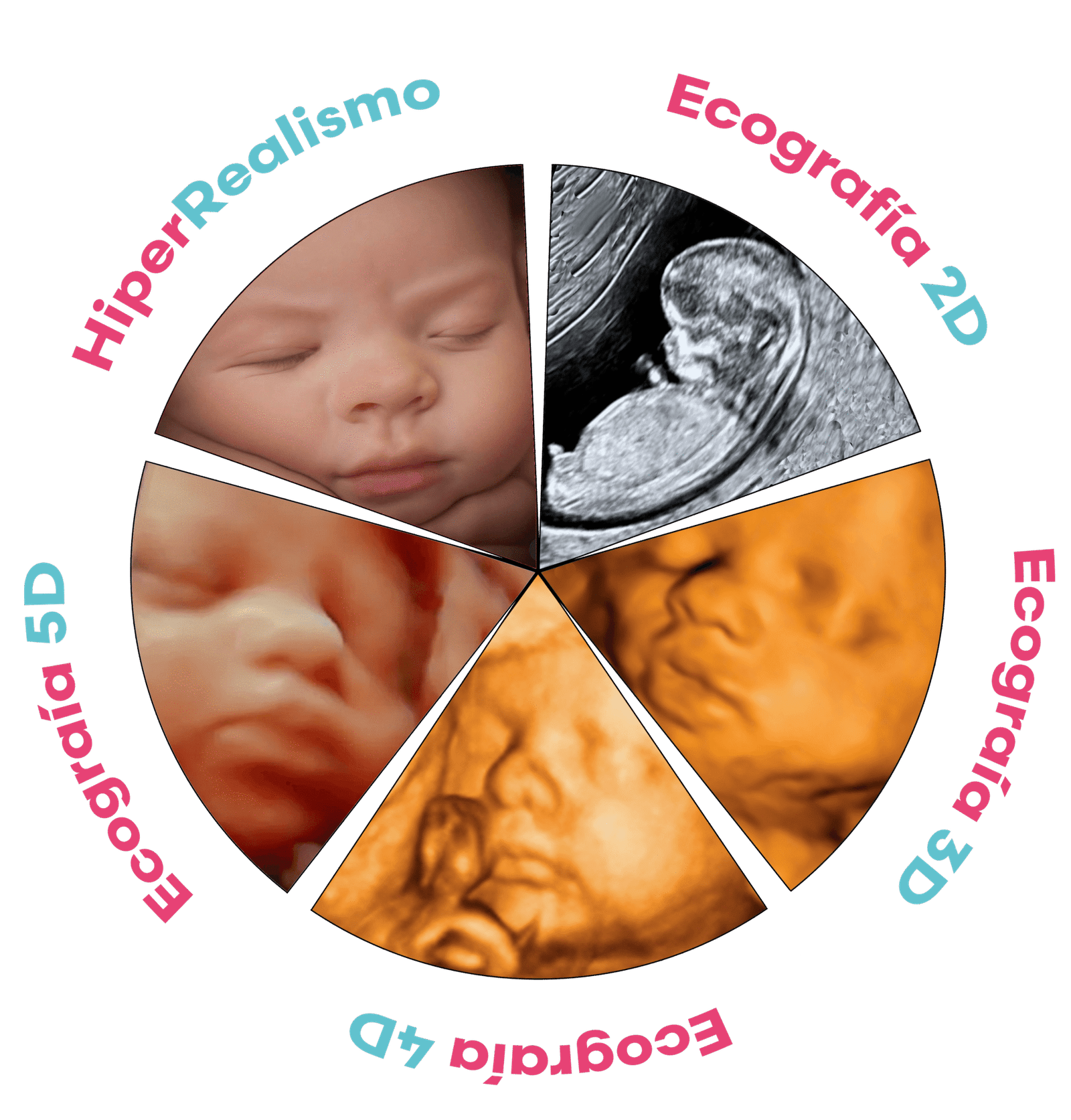 Ecografía Emocional 5D en Elda