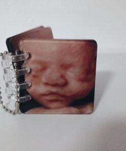 Mini álbum de metacrilato con fotos de ecografía