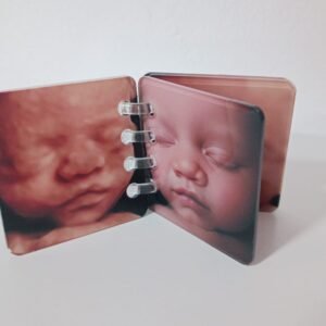 Mini álbum de metacrilato con fotos de ecografía